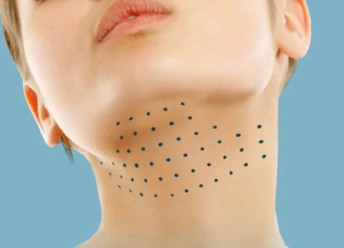 Face, Chin and Body Fat Dissolving Treatment