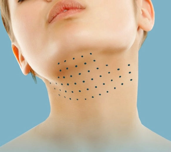 Face, Chin and Body Fat Dissolving Treatment